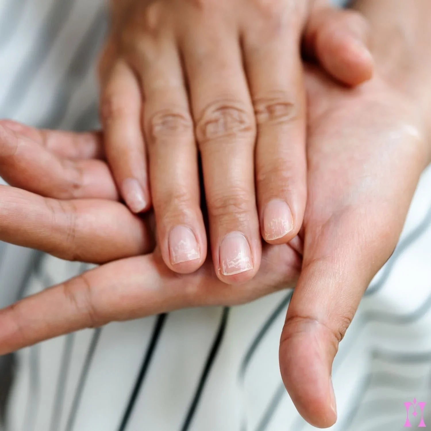 How-Do-I-Repair-Broken-Weak-Nails mesme